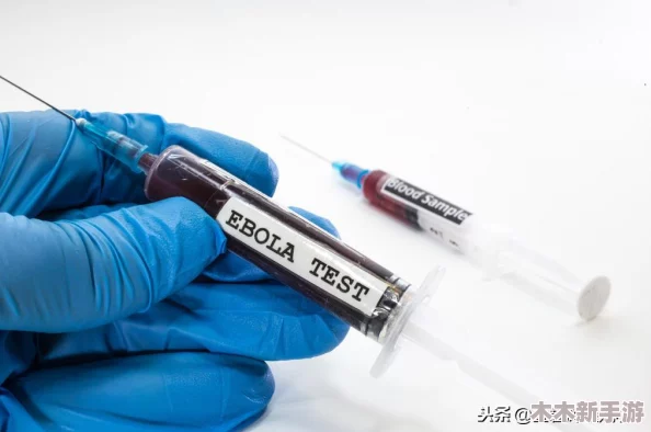 探索致命解药游戏存档点，创新刷取稀有服饰的高效技巧