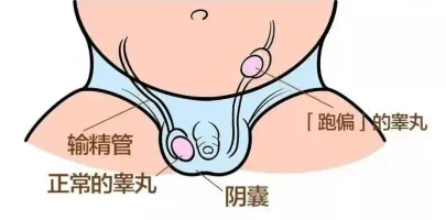 “睾丸进入子宫的里面长肉粒正常吗？网友热议：这可能是身体发出的警告信号！”