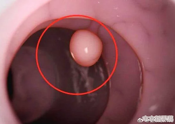 “睾丸进入子宫的里面长肉粒正常吗？网友热议：这可能是身体发出的警告信号！”