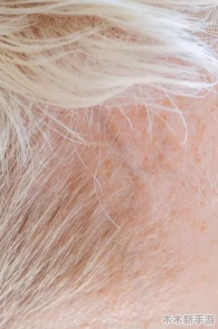 胡桃流出白色脓状物，可能是由于细菌感染或其他健康问题引起的，需要及时就医以确定病因和治疗方案