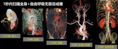 《辐射4》世界探索：血流不止VS辐射侵蚀，哪者杀伤力更胜一筹？