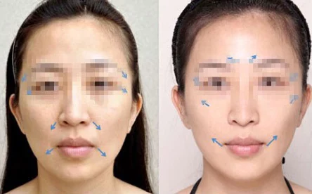 sp发刷 红肿 双丘双男主：如何正确处理皮肤问题？