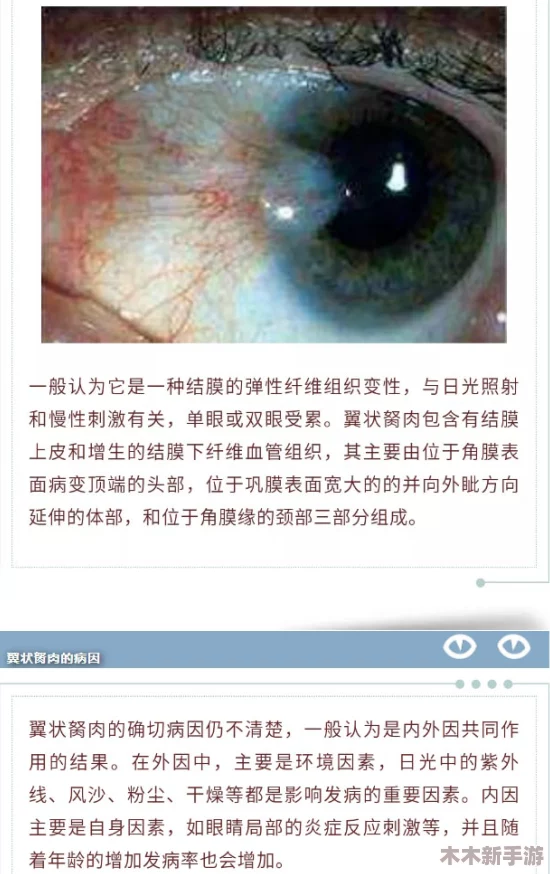关于＂超级胬肉系统第二部叫什么＂的详细解读与分析