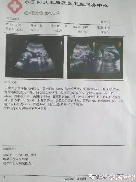 理解alpha孕囊顶开分娩的过程与影响，助力顺利生产与母婴健康