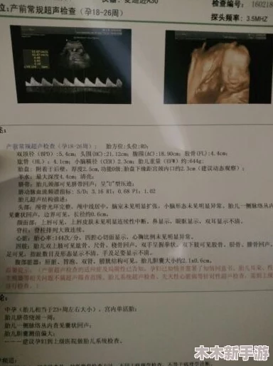 理解alpha孕囊顶开分娩的过程与影响，助力顺利生产与母婴健康